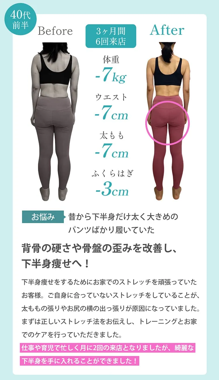 ビフォーアフター