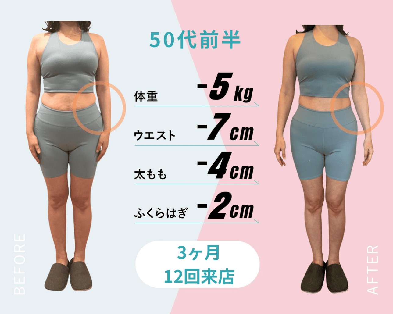 ビフォーアフター4